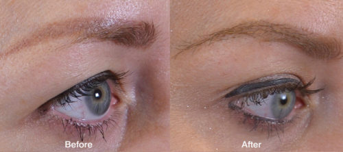 Eyebrows-Right1