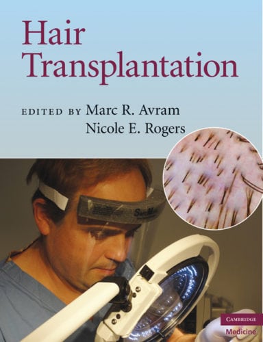 hairtransplantationbookcover