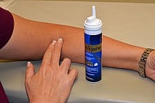 rogaine-elbow-use-test-34-jpg