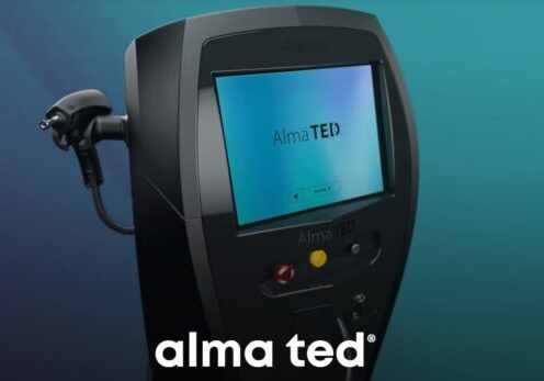 Alma