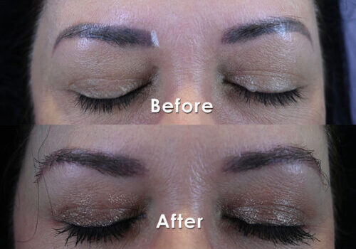 Eyebrow-Full-BA